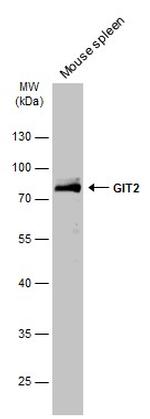 GIT2 Antibody in Western Blot (WB)