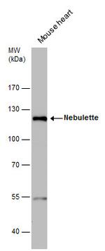 NEBL Antibody in Western Blot (WB)