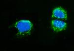 AMHR2 Antibody in Immunocytochemistry (ICC/IF)