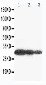 Aquaporin 6 Antibody in Western Blot (WB)