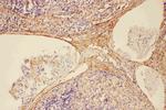 Complement C5a Antibody in Immunohistochemistry (Paraffin) (IHC (P))