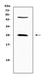 CTLA-4 (CD152) Antibody in Western Blot (WB)