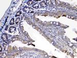 FLT3 (CD135) Antibody in Immunohistochemistry (Paraffin) (IHC (P))