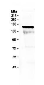 FLT3 (CD135) Antibody in Western Blot (WB)