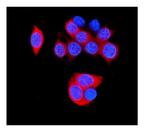 HSPB8 Antibody in Immunocytochemistry (ICC/IF)