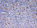 IGF1R (CD221) Antibody in Immunohistochemistry (Paraffin) (IHC (P))