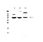 IL18BP Antibody in Western Blot (WB)