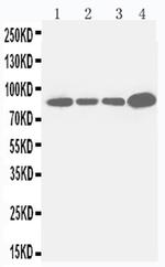 CD61 (Integrin beta 3) Antibody in Western Blot (WB)