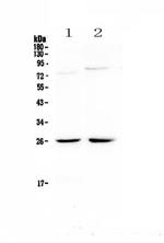 NMU Antibody in Western Blot (WB)