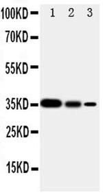 SHC Antibody in Western Blot (WB)