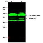 CK2 alpha-2 Antibody in Immunoprecipitation (IP)