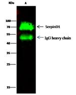 Heparin Cofactor II Antibody in Immunoprecipitation (IP)