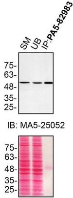 Annexin A11 Antibody in Immunoprecipitation (IP)