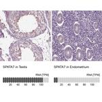 SPATA7 Antibody