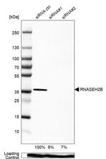 RNaseH2B Antibody
