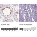 KPNA5 Antibody