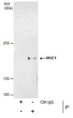 MUC1 Antibody in Immunoprecipitation (IP)