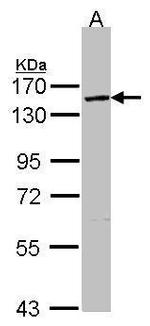 VCPIP1 Antibody in Western Blot (WB)
