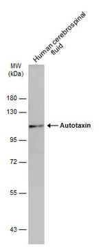 ENPP2 Antibody in Western Blot (WB)