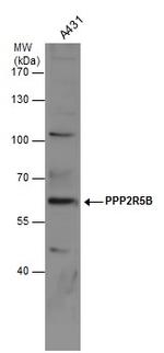 PPP2R5B Antibody in Western Blot (WB)