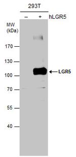 LGR5 Antibody in Western Blot (WB)