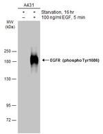 Phospho-EGFR (Tyr1086) Antibody in Western Blot (WB)