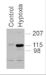 HIF-2 alpha Antibody in Western Blot (WB)