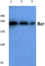 BCR Antibody in Western Blot (WB)