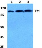 Thrombomodulin Antibody in Western Blot (WB)