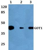GOT1 Antibody in Western Blot (WB)