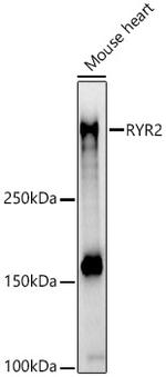 RyR2 Antibody in Western Blot (WB)
