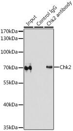 CHK2 Antibody in Immunoprecipitation (IP)