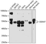DDX47 Antibody in Western Blot (WB)