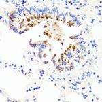 AMBRA1 Antibody in Immunohistochemistry (Paraffin) (IHC (P))