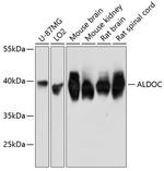 Aldolase C Antibody in Western Blot (WB)