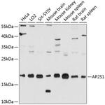 AP2S1 Antibody in Western Blot (WB)