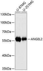 ANGEL2 Antibody in Western Blot (WB)