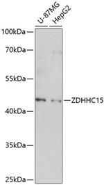 ZDHHC15 Antibody in Western Blot (WB)