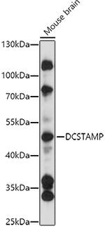 TM7SF4 Antibody in Western Blot (WB)