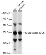 GCK Antibody in Western Blot (WB)