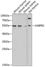 GABPB2 Antibody in Western Blot (WB)
