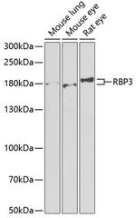 RBP3 Antibody in Western Blot (WB)