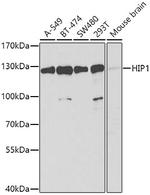 HIP1 Antibody in Western Blot (WB)