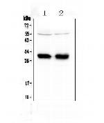 HLA-DRB1 Antibody in Western Blot (WB)