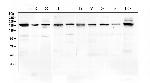 PCDH15 Antibody in Western Blot (WB)