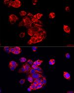 ECHS1 Antibody in Immunocytochemistry (ICC/IF)