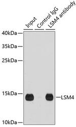 LSM4 Antibody in Immunoprecipitation (IP)