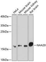 NAA20 Antibody in Western Blot (WB)