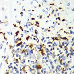 CAPG Antibody in Immunohistochemistry (Paraffin) (IHC (P))