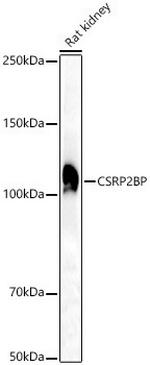 CSRP2BP Antibody in Western Blot (WB)